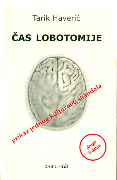 Čas lobotomije
